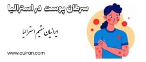 سرطان پوست در استرالیا سالانه جان بیش از 2000 نفر را می گیرد که بیش از 750000 مورد تشخیص و درمان می شوند